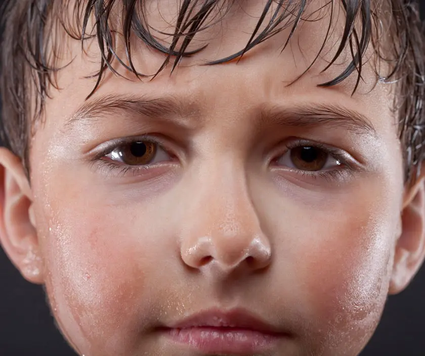 Child sweating